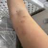 https://cdn.worldota.net/t/100x100/hotel_review/17/27/17276cfb9d14048bc27063f584be686a62183705.JPEG