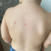 https://cdn.worldota.net/t/100x100/hotel_review/57/c4/57c4cc11202438e1e324e912e3b1e8c69e008d18.jpeg