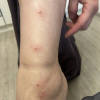 https://cdn.worldota.net/t/100x100/hotel_review/62/5c/625cdc5cbc704b3dc62fdb2141d44d3561baa5e2.JPEG
