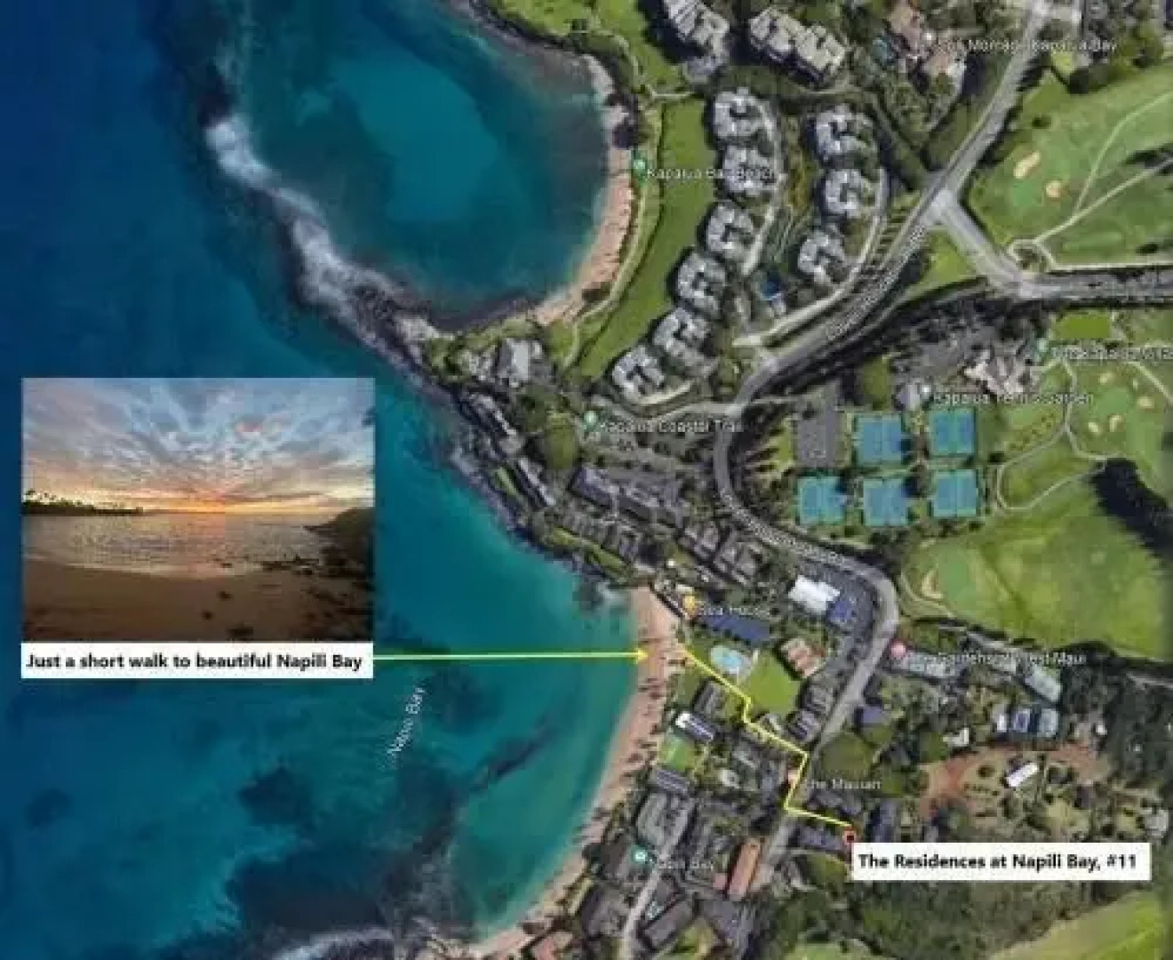 Napili Gardens 11