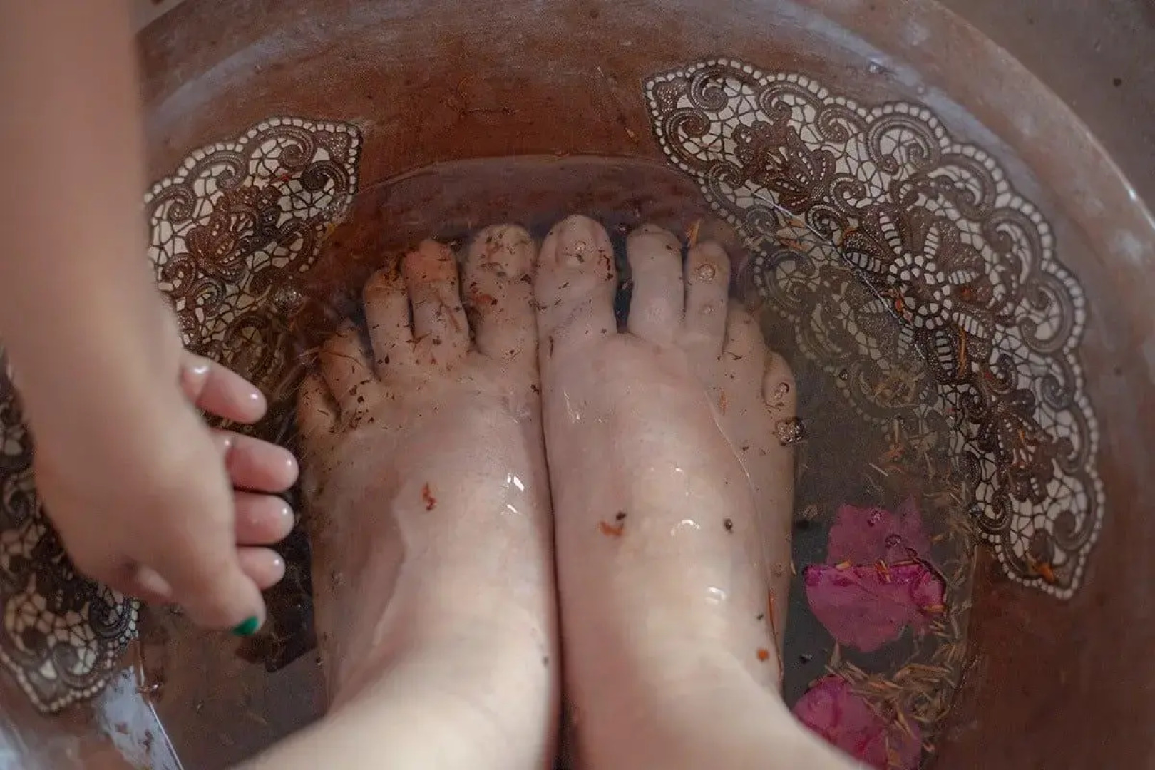 Hotel Varandas Beach